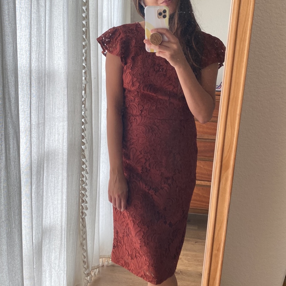 H&M Lace Dress *New*
